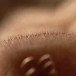 5 Maneras de Deshacerte de Piojos y Liendres Sin Estrés