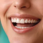 una boca con dientes perfectos