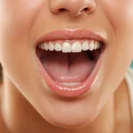 ¿Cómo Eliminar el Sarro de los Dientes en Casa?